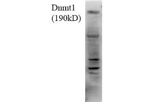 Western Blot analysis of Human H1299 cell lysate showing detection of DNMT1 protein using Mouse Anti-DNMT1 Monoclonal Antibody, Clone 4G11-C7 . (DNMT1 anticorps  (AA 620-950) (APC))