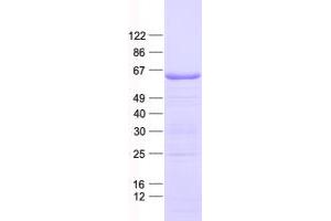 Validation with Western Blot