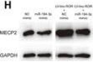 linc-ROR promoted cell proliferation, migration, and invasion of breast cancer through linc-ROR/miR-194-3p/MECP2 regulatory axis. (MECP2 anticorps  (AA 1-100))
