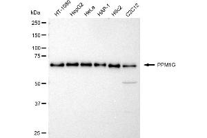 Western blotting analysis using PPM1G antibody (ABIN7800035).