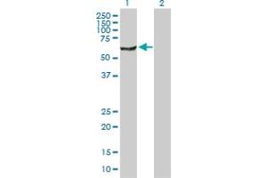 Western Blot analysis of NARS expression in transfected 293T cell line by NARS MaxPab polyclonal antibody. (NARS anticorps  (AA 1-548))
