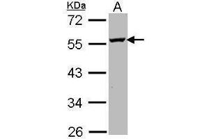 WB Image Sample (30 ug of whole cell lysate) A: Molt-4 , 10% SDS PAGE antibody diluted at 1:1000 (ODC1 anticorps)