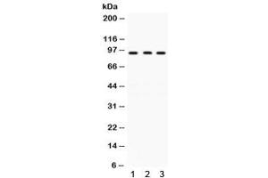 Western blot testing of human 1) A431, 2) 22RV1 and 3) COLO320 lysate with GCN5 antibody. (KAT2A anticorps)