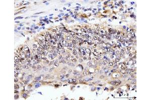 IHC analysis of AKAP 95/AKAP8 using anti-AKAP 95/AKAP8 antibody (ABIN7601553). (AKAP8 anticorps  (AA 380-546))