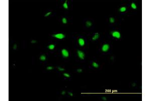 Immunofluorescence of purified MaxPab antibody to BCCIP on HeLa cell.