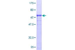 Image no. 1 for Heat Shock Protein 90kDa beta (Grp94), Member 1 (HSP90B1) (AA 1-315) protein (GST tag) (ABIN1307186)