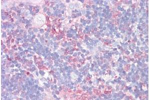 Anti-LGALS9 / Galectin-9 antibody IHC staining of human thymus. (Galectin 9 anticorps  (AA 51-100))