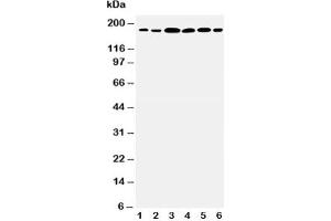 Western blot testing of Laminin gamma 1 antibody and Lane 1:  rat kidney;  2: rat lung;  3: U87;  4: SMMC-7721;  5: HeLa;  6: SKOV3 cell lysate (Laminin gamma 1 anticorps  (AA 1566-1579))