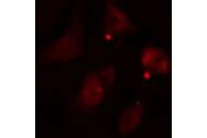 ABIN6274582 staining HepG2 cells by IF/ICC. (ADD3 anticorps  (Internal Region))
