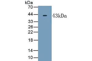 Detection of Recombinant RAMP2, Human using Polyclonal Antibody to Receptor Activity Modifying Protein 2 (RAMP2) (RAMP2 anticorps  (AA 43-145))