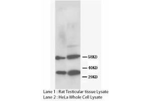 Image no. 2 for anti-DNA Repair Protein Homolog 1 (RAD51) (N-Term) antibody (ABIN1495062) (RAD51 anticorps  (N-Term))