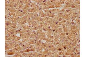 IHC image of ABIN7146081 diluted at 1:100 and staining in paraffin-embedded human liver tissue performed on a Leica BondTM system. (CLEC4G anticorps  (AA 66-293))