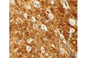 Immunohistochemistry (IHC) image for anti-rho-Associated, Coiled-Coil Containing Protein Kinase 2 (ROCK2) (Middle Region) antibody (ABIN1031072) (ROCK2 anticorps  (Middle Region))