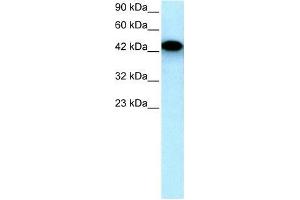 Human HepG2; WB Suggested Anti-EYA3 Antibody Titration: 0. (EYA3 anticorps  (Middle Region))