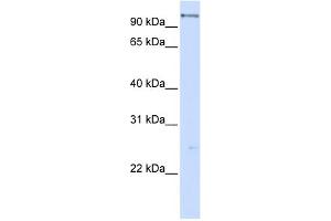 WB Suggested Anti-DHX15 Antibody Titration:  0. (DHX15 anticorps  (C-Term))