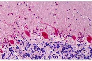 Human Brain: Formalin-Fixed, Paraffin-Embedded (FFPE)