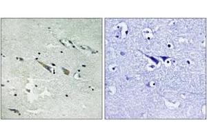 Immunohistochemistry (IHC) image for anti-V-Raf-1 Murine Leukemia Viral Oncogene Homolog 1 (RAF1) (AA 251-300) antibody (ABIN2889118) (RAF1 anticorps  (AA 251-300))