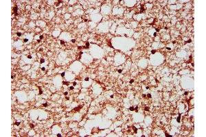 IHC image of ABIN7170618 diluted at 1:200 and staining in paraffin-embedded human brain tissue performed on a Leica BondTM system.