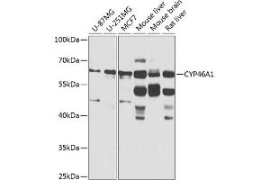 Western blot analysis of extracts of various cell lines, using CYP46 antibody (ABIN6130168, ABIN6139358, ABIN6139359 and ABIN6224675) at 1:1000 dilution. (CYP46A1 anticorps  (AA 24-280))