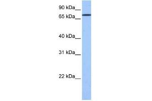 GK2 antibody used at 1 ug/ml to detect target protein. (GK2 anticorps  (C-Term))