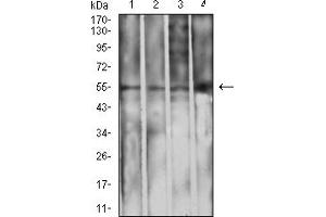 Western blot analysis using IghA1 mouse mAb against L1210 (1), THP-1 (2), HepG2 (3), and COS7 (4) cell lysate. (IGHA1 anticorps  (AA 207-353))