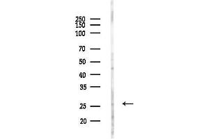 anti-Coiled-Coil-Helix-Coiled-Coil-Helix Domain Containing 6 (CHCHD6) (Internal Region) antibody