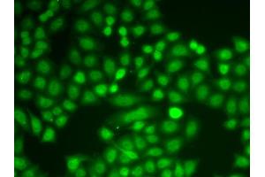 Immunofluorescence analysis of A549 cells using PYCARD antibody (ABIN4904914). (PYCARD anticorps)