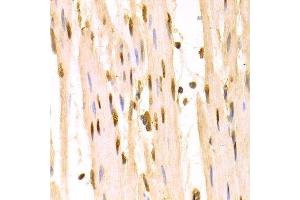 Immunohistochemistry of paraffin-embedded human esophagus using SFN Antibody. (14-3-3 sigma/SFN anticorps  (AA 1-248))