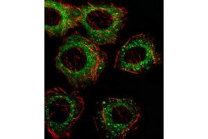 Immunofluorescence (IF) image for anti-Fatty Acid Desaturase 2 (FADS2) antibody (ABIN2928602) (FADS2 anticorps)