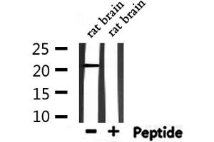 Western blot analysis of extracts from rat brain, using RAP1A Antibody.