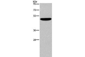 Western Blot analysis of SKOV3 cell using NECTIN4 Polyclonal Antibody at dilution of 1:350 (PVRL4 anticorps)