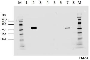 Cell lyzates of HEK293T/17 cells transiently transfected with expression vectors harboring genes for mCD3zeta wild type and six different mCD3zeta mutants, where particular ITAM tyrosines were substituted with phenylalanines, were prepared.