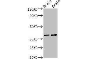 Western Blot Positive WB detected in: Rat brain tissue, Mouse brain tissue All lanes: GNB1 antibody at 3 μg/mL Secondary Goat polyclonal to rabbit IgG at 1/50000 dilution Predicted band size: 38, 37 kDa Observed band size: 38 kDa (GNB1 anticorps  (AA 157-248))