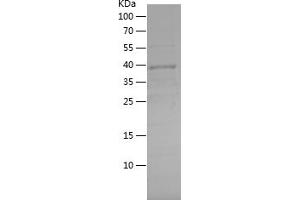 Western Blotting (WB) image for Breast Cancer 2, Early Onset (BRCA2) (AA 1-160) protein (His-IF2DI Tag) (ABIN7122032)
