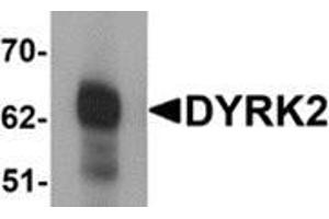 Western blot analysis of DYRK2 in 293 cell lysate with DYRK2 antibody at (A) 1 and (B) 2 μg/ml. (DYRK2 anticorps  (C-Term))