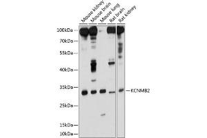 Western blot analysis of extracts of various cell lines, using KCNMB2 antibody (ABIN6129436, ABIN6142762, ABIN6142763 and ABIN6214468) at 1:1000 dilution. (KCNMB2 anticorps  (AA 68-194))