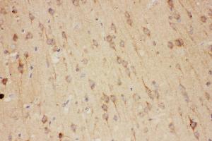 Anti-RTN3 antibody, IHC(P) IHC(P): Rat Brain Tissue (Reticulon 3 anticorps  (C-Term))