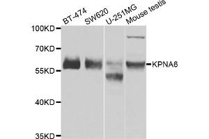 Western blot analysis of extracts of various cell lines, using KPNA6 antibody (ABIN5975280) at 1/1000 dilution. (KPNA6 anticorps)