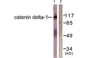 Western blot analysis of extracts from HuvEc cells, using Catenin-delta1 (Ab-228) Antibody. (CTNND1 anticorps  (AA 201-250))