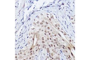 Immunohistochemistry of paraffin-embedded rat bladder using SSC/SerpinB3 Rabbit mAb (ABIN7270242) at dilution of 1:100 (40x lens). (SERPINB3 anticorps)