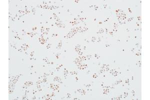 Immunocytochemistry (ICC) image for anti-Mediator Complex Subunit 12 (MED12) (AA 2127-2177) antibody (ABIN7453977)
