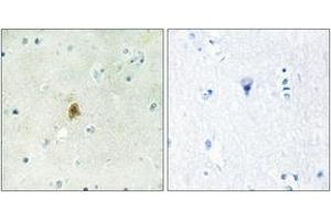 Immunohistochemistry analysis of paraffin-embedded human brain tissue, using TAF15 Antibody. (TAF15 anticorps  (AA 351-400))