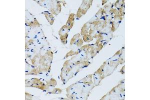 Immunohistochemistry of paraffin-embedded rat heart using GABARAP antibody.