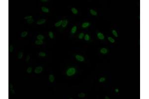 Immunofluorescence staining of Hela Cells with ABIN7127654 at 1:50, counter-stained with DAPI. (Recombinant MAPK14 anticorps)