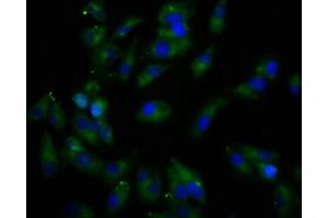 Immunofluorescence staining of Hela cells with ABIN7167082 at 1:166, counter-stained with DAPI. (REPS1 anticorps  (AA 105-230))