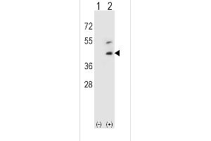 Western blot analysis of DCN using rabbit polyclonal DCN Antibody using 293 cell lysates (2 ug/lane) either nontransfected (Lane 1) or transiently transfected (Lane 2) with the DCN gene. (Decorin anticorps  (AA 122-150))