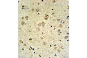 P4K3 Antibody (ABIN653817 and ABIN2843090) IHC analysis in forlin fixed and paraffin embedded brain tissue followed by peroxidase conjugation of the secondary antibody and DAB staining.