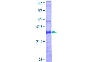 Image no. 1 for Mannose Receptor, C Type 1 (MRC1) (AA 22-130) protein (GST tag) (ABIN1311262)