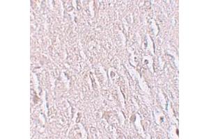 Immunohistochemistry (IHC) image for anti-Zinc Finger and BTB Domain Containing 5 (ZBTB5) (C-Term) antibody (ABIN1030813) (ZBTB5 anticorps  (C-Term))