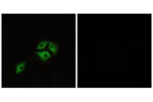 Immunofluorescence analysis of A549 cells, using NMBR antibody. (NMBR anticorps  (Internal Region))